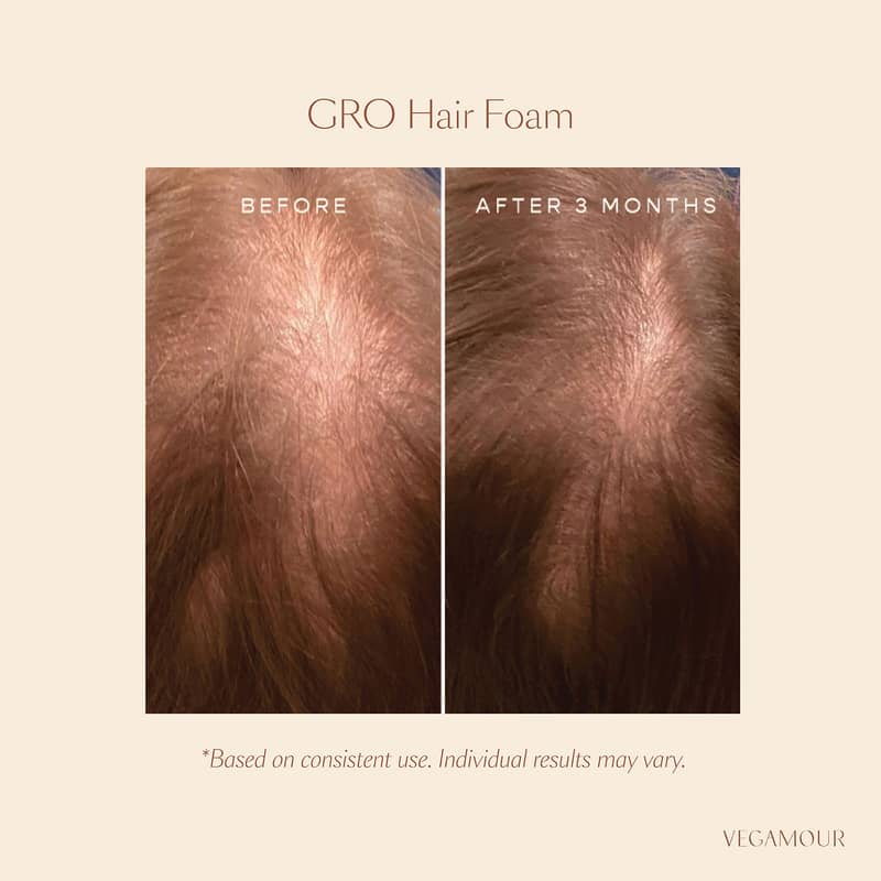 Vegamour GRO Hair Foam for Thinning Hair 31g